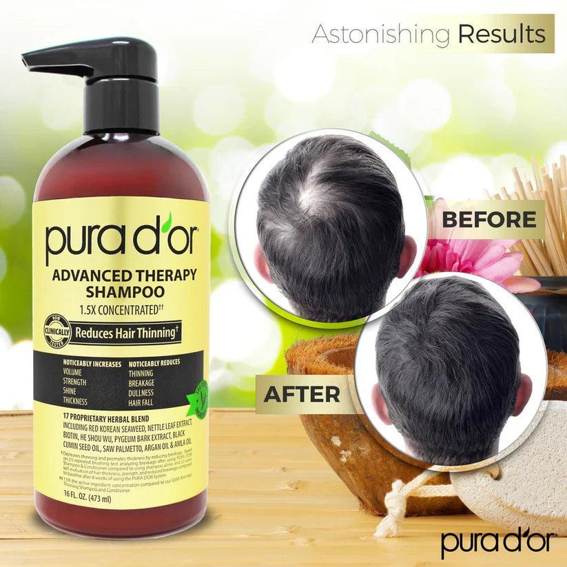 PURA D'OR Advanced Therapy Biotin Hair Shampoo - The Curl Lounge